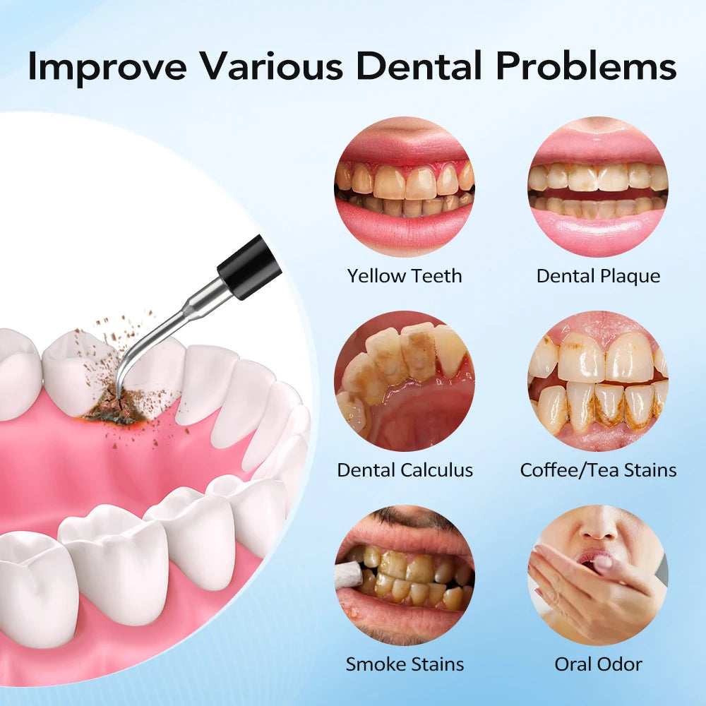 Electric Sonic Dental Calculus & Plaque Remover for Home Teeth Whitening - 11