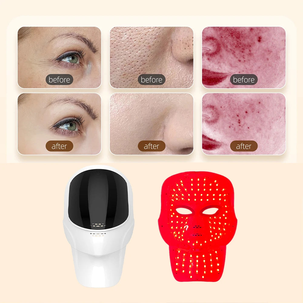 7-Color LED Face & Neck Light Therapy Mask Wireless - 12