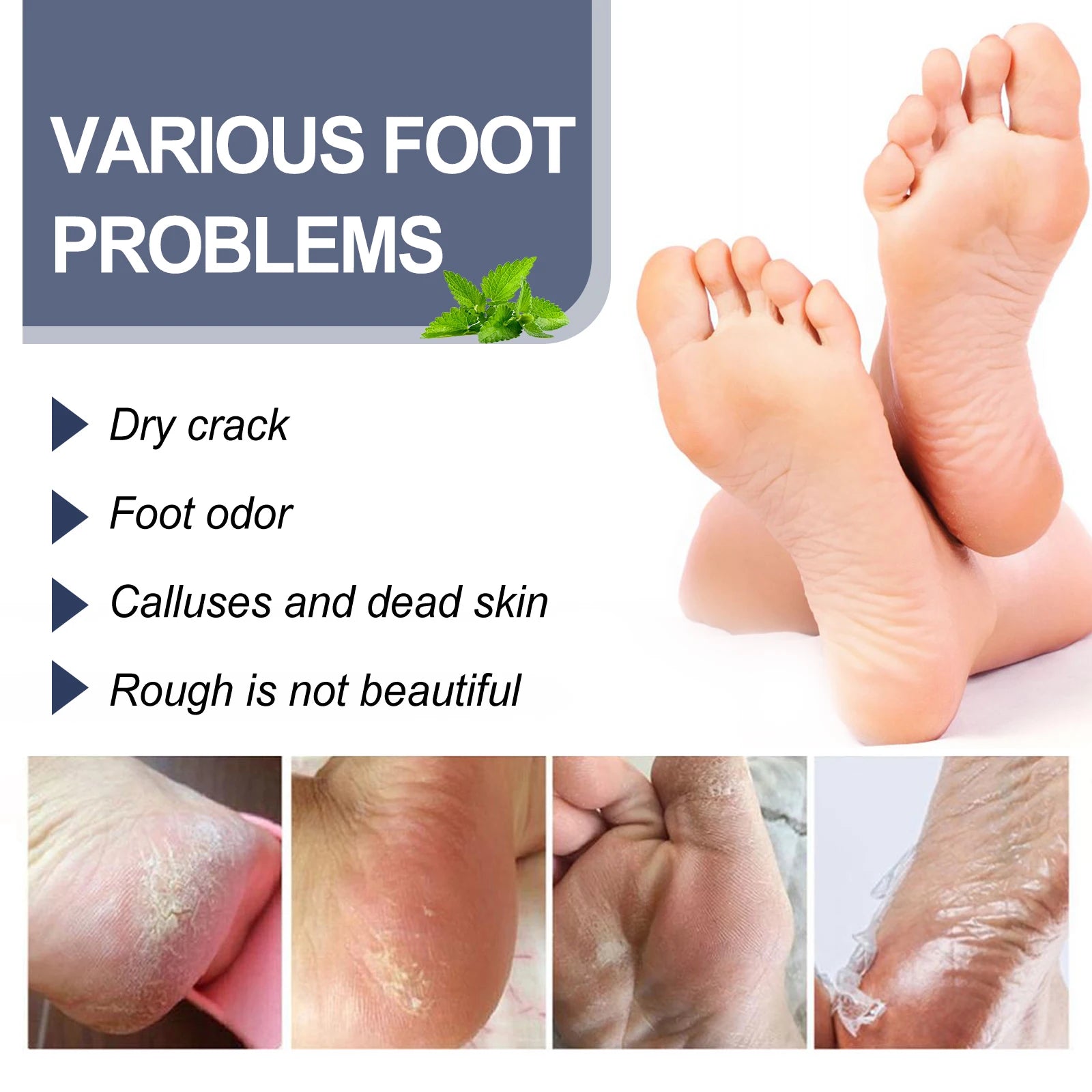 Refreshing Foot Deodorant Spray - Anti-Odor & Nourishing Heel Care - 8