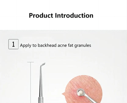 Professional Stainless Steel Blackhead Extractor & Pimple Popper Tool Kit