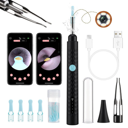 2-in-1 Visual Ear Wax Cleaner with HD Camera and Precision Tweezers