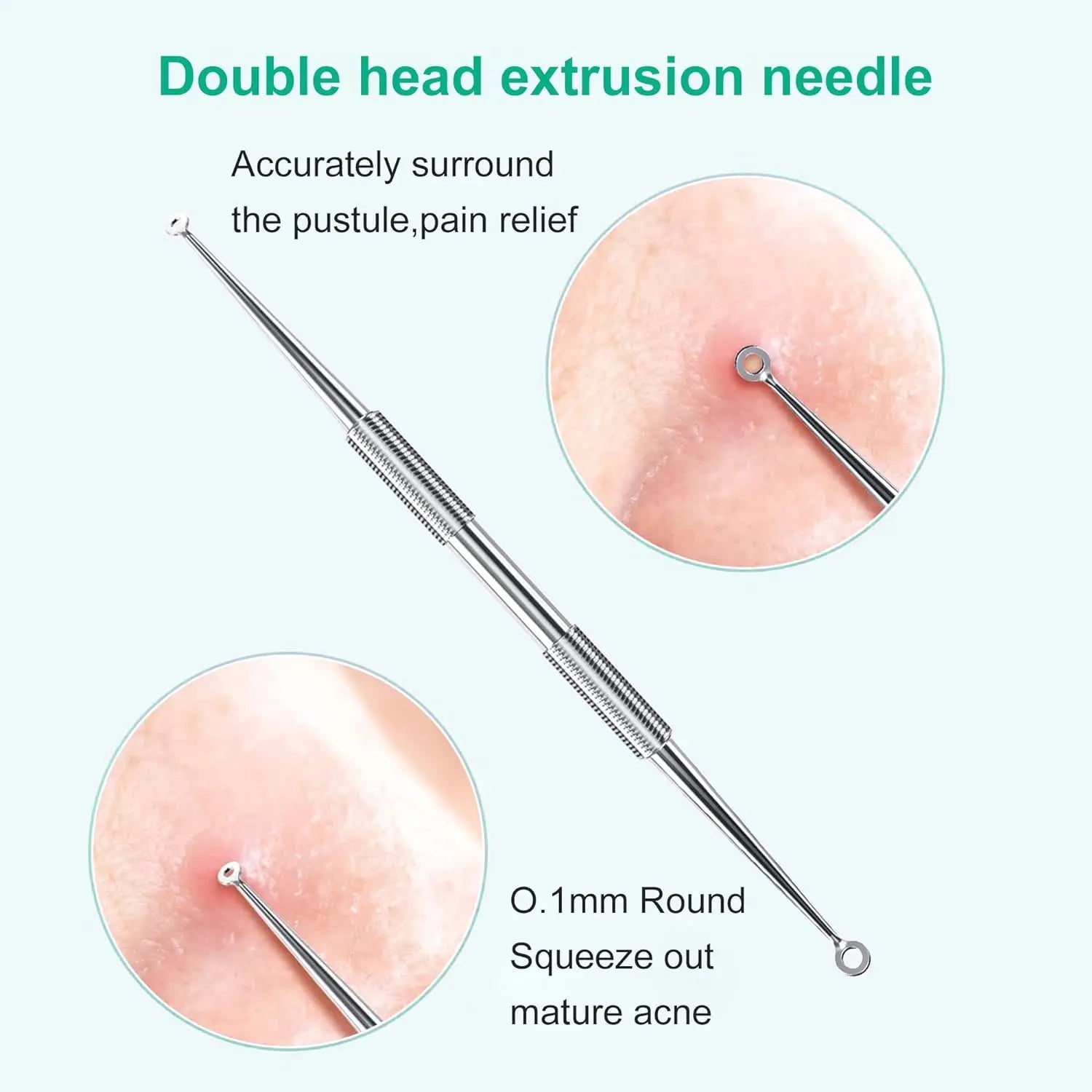 Professional Stainless Steel Blackhead Extractor & Pimple Popper Tool Kit - 3