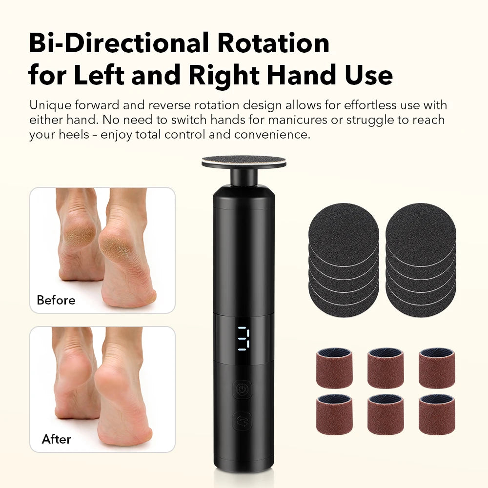 Electric Foot Callus Remover - 6-Speed Rechargeable Pedicure Tool for Smooth Heels - 2