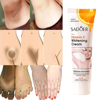 Vitamin C Brightening Cream for Dark Spots, Underarms, Elbows and Knees