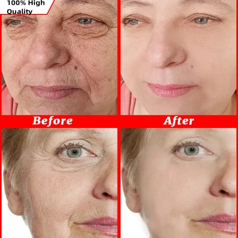Anti-Aging Face Cream for Instant Wrinkle Removal & Skin Firming - 2