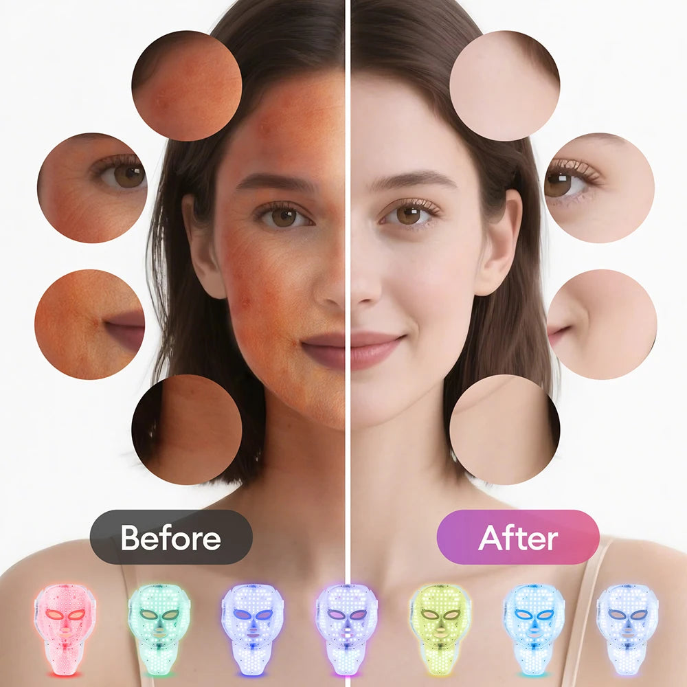 Wireless 7-Color LED Light Therapy Face & Neck Mas...01916c47.webp