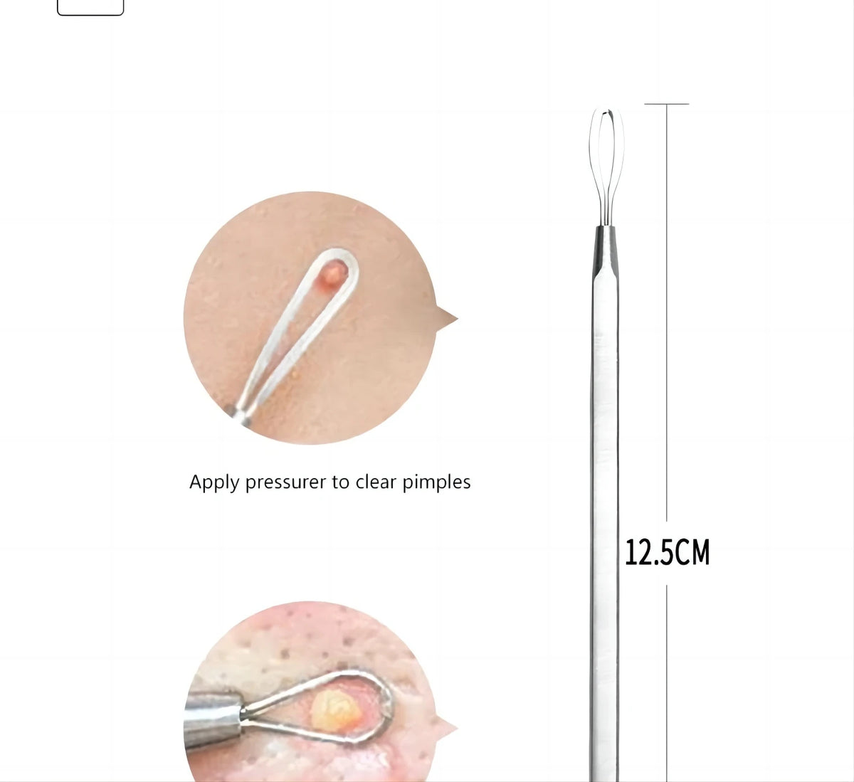Professional Stainless Steel Blackhead Extractor & Pimple Popper Tool Kit
