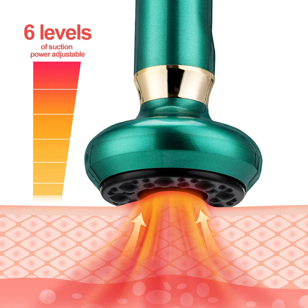 Electric Cupping Massager - Smart Vacuum Gua Sha Therapy