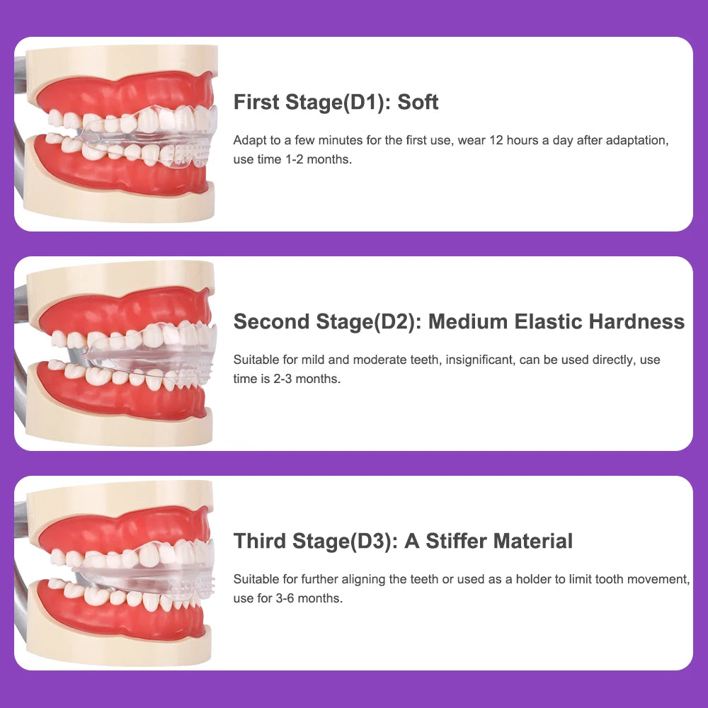 3-Stage Dental Teeth Trainer & Orthodontic Alignment Braces for Adults