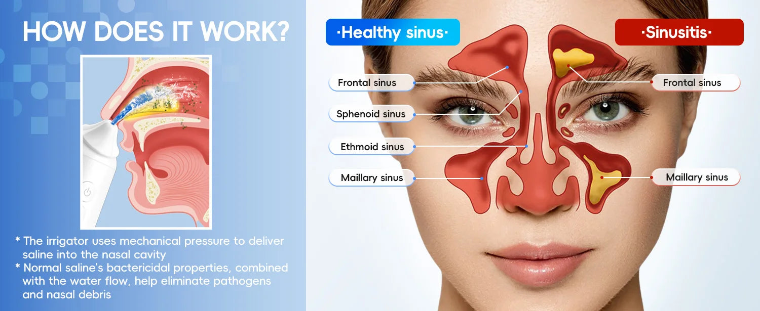 Electric Nasal Irrigation System for Sinus Relief and Nasal Congestion - 9