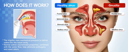 Electric Nasal Irrigation System for Sinus Relief and Nasal Congestion