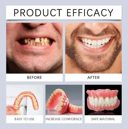 Cosmetic Smile Veneers - Comfortable Upper & Lower Natural Look Teeth