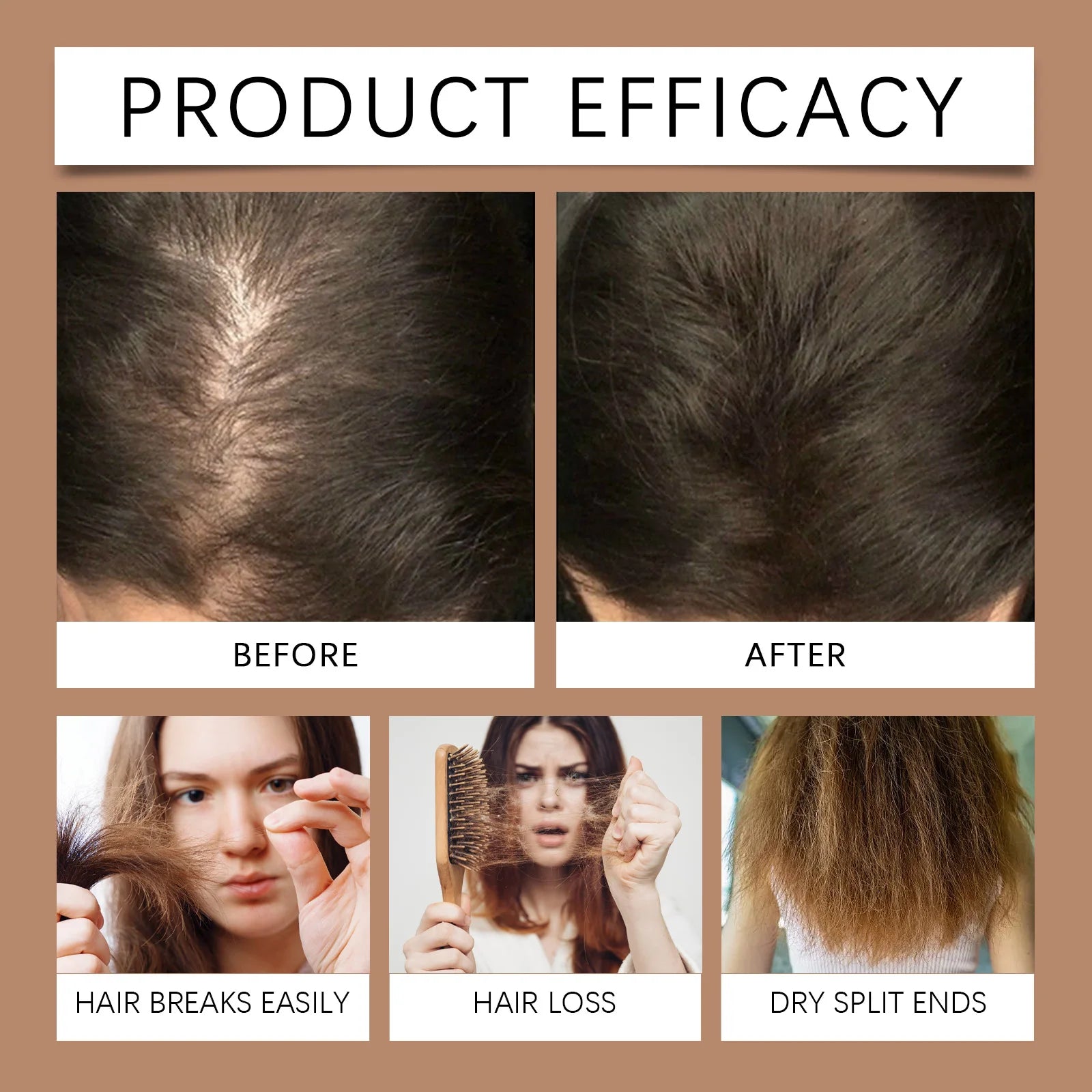 Batana & Rosemary Hair Growth Shampoo for Deep Scalp Repair & Anti-Dandruff - 10