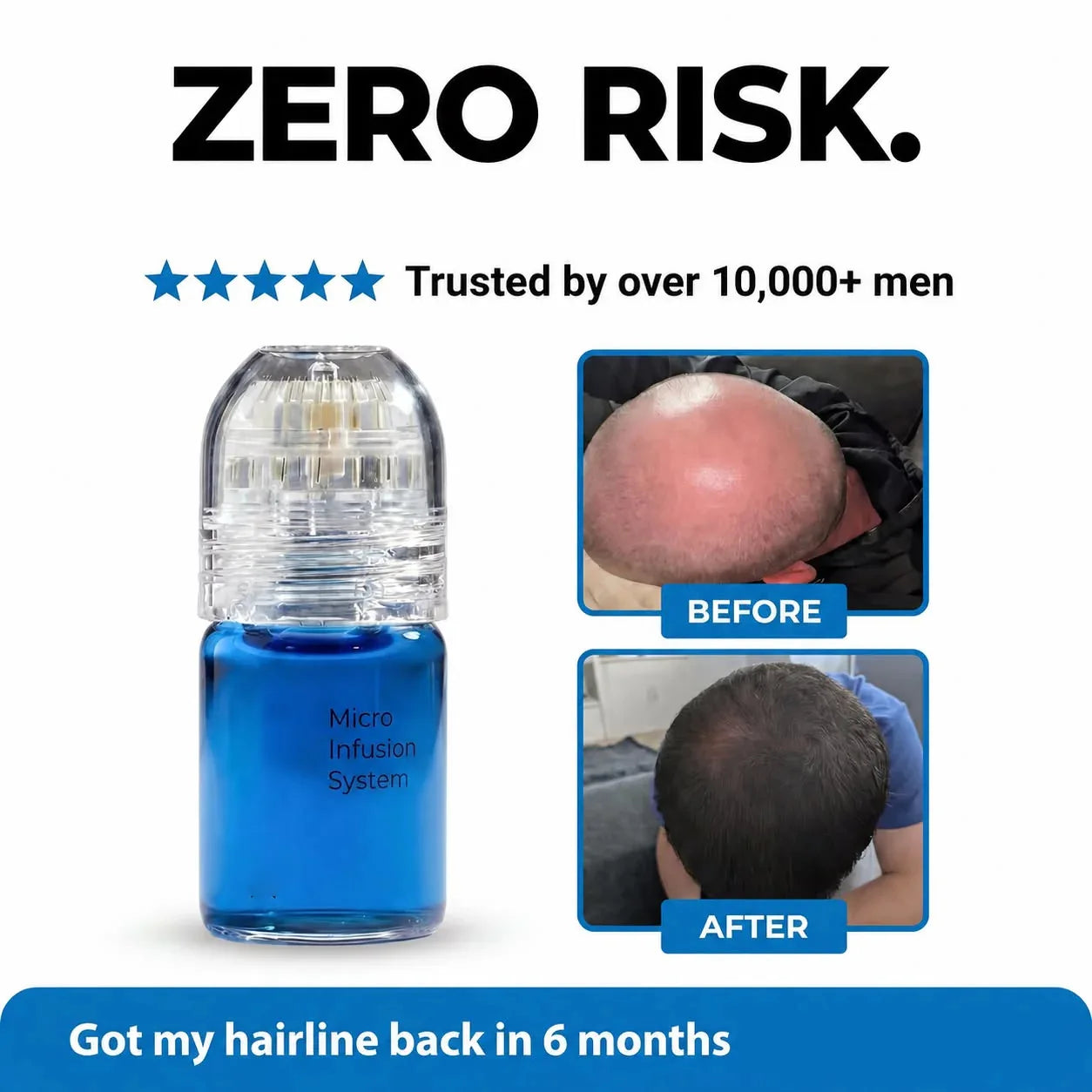 Micro Infusion Scalp Serum Hair Regrowth & Follicle Strengthening Treatment - 2