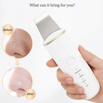 Ultrasonic Face Skin Scrubber - Deep Pore Cleansing & Blackhead Remover Spatula
