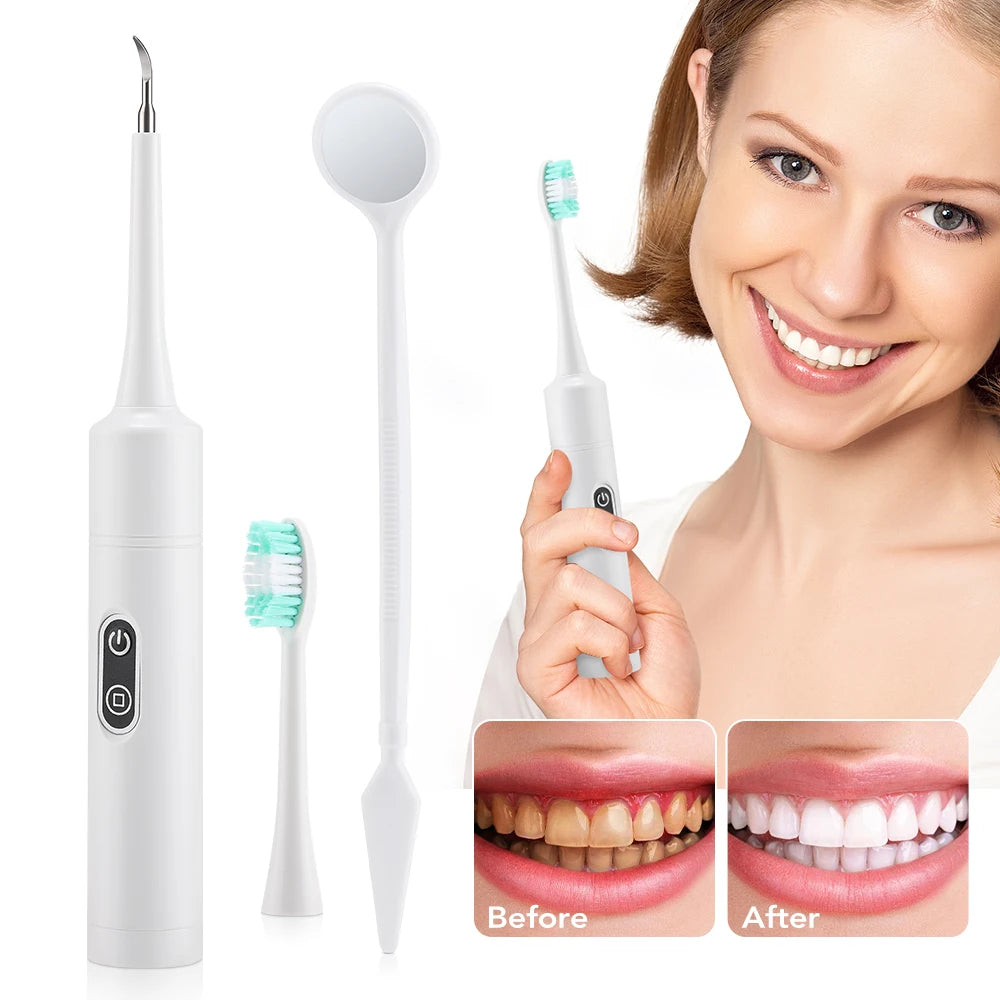 Electric Sonic Dental Calculus & Plaque Remover for Home Teeth Whitening - 7