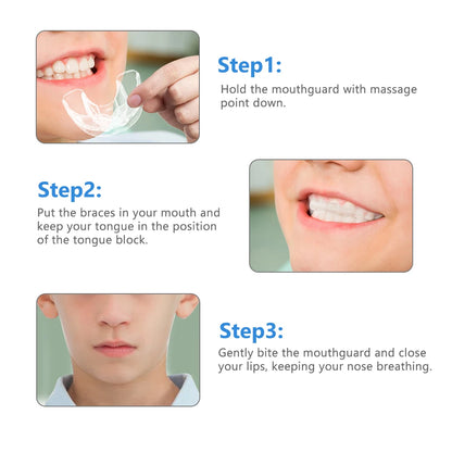 3-Stage Dental Orthodontic Alignment Trainer for Kids Teeth Straightening