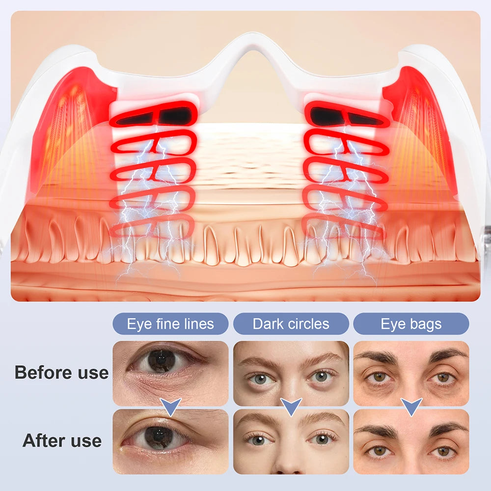 Electric EMS Red Light Eye Massager for Fatigue & Wrinkles - 4
