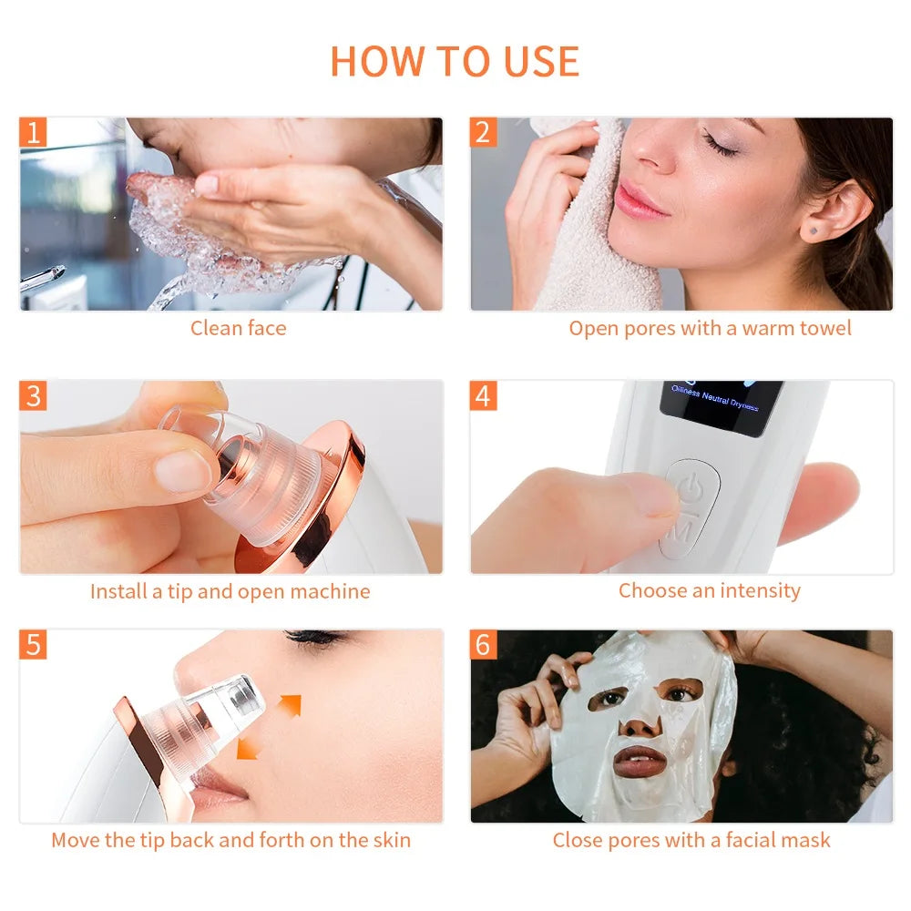 Electric Vacuum Blackhead Remover & Facial Pore Cleanser - 18