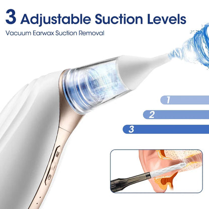 Intelligent Electric Earwax Removal Vacuum Cleaner with Adjustable Suction