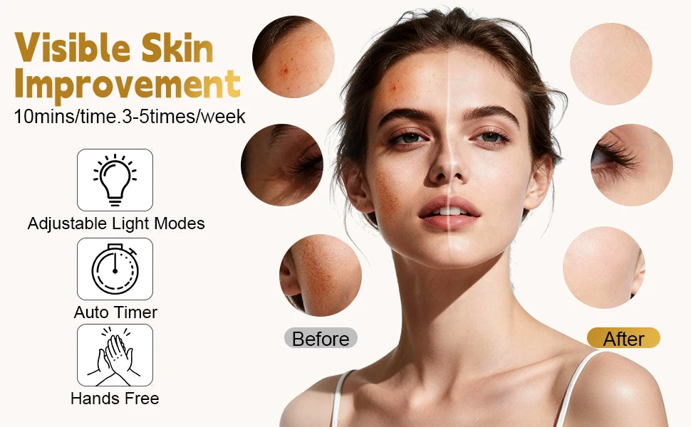 7-Color LED Facial Mask - Rechargeable Silicone Light Therapy Skin Care Device - 9