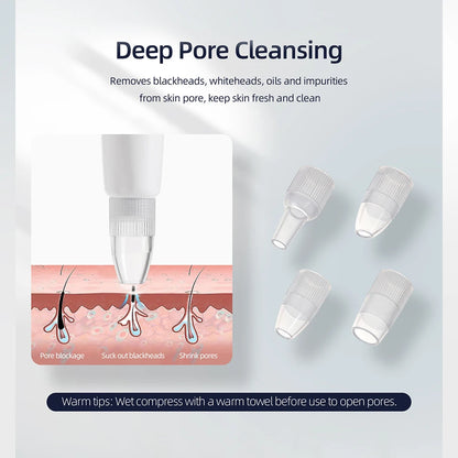 Professional 3-in-1 Diamond Microdermabrasion Facial Machine
